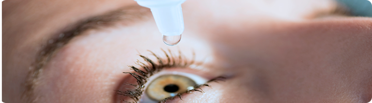 how to treat styes